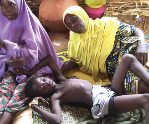 Nigeria records 532 meningitis cases and 124 deaths